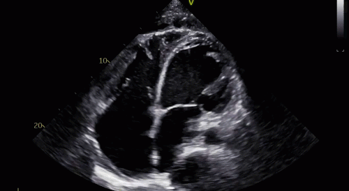 New Basic Echocardiography Course