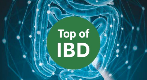 Top of IBD