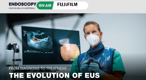 Endoscopy on Air Fujifilm