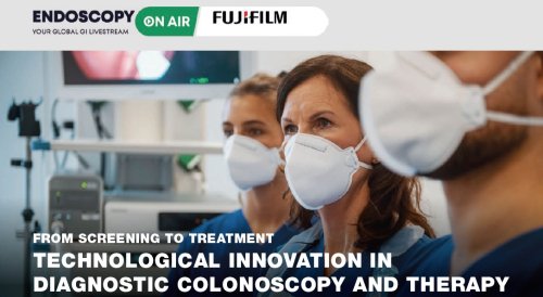 Endoscopy on Air